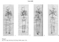 Chronicle of the Archaeological Excavations in Romania, 2005 Campaign. Report no. 201, Tunari<br /><a href='CronicaCAfotografii/2005/201/rsz-4.jpg' target=_blank>Display the same picture in a new window</a>