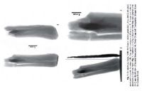 Cronica Cercetărilor Arheologice din România, Campania 2013. Raportul nr. 31, Fântânele, La Gâţa (Dâmbul Popii)<br /><a href='CronicaCAfotografii/2013/031-fantanele/7.jpg' target=_blank>Priveşte aceeaşi imagine într-o fereastră nouă</a>