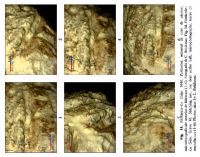 Cronica Cercetărilor Arheologice din România, Campania 2013. Raportul nr. 31, Fântânele, La Gâţa (Dâmbul Popii)<br /><a href='CronicaCAfotografii/2013/031-fantanele/fig-14.jpg' target=_blank>Priveşte aceeaşi imagine într-o fereastră nouă</a>