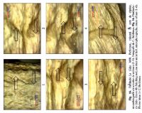 Cronica Cercetărilor Arheologice din România, Campania 2013. Raportul nr. 31, Fântânele, La Gâţa (Dâmbul Popii)<br /><a href='CronicaCAfotografii/2013/031-fantanele/fig-16_1.jpg' target=_blank>Priveşte aceeaşi imagine într-o fereastră nouă</a>
