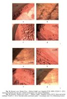 Cronica Cercetărilor Arheologice din România, Campania 2013. Raportul nr. 84, Păuleni-Ciuc, Dâmbul Cetăţii (Dealul Cetăţii, Vardomb)<br /><a href='CronicaCAfotografii/2013/084-soimeni/fig-14.jpg' target=_blank>Priveşte aceeaşi imagine într-o fereastră nouă</a>